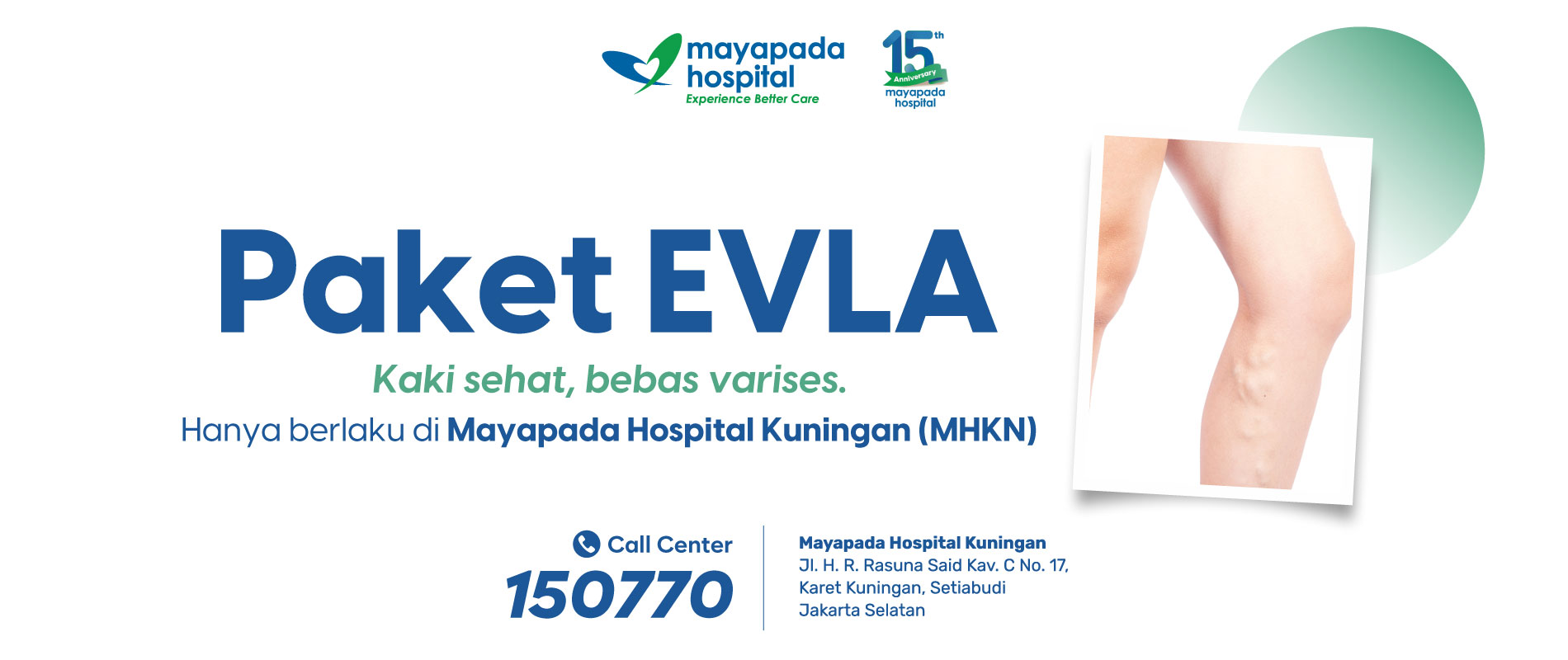 Promo Tindakan Varises (EVLA) Mayapada Hospital Kuningan (MHKN) IMG